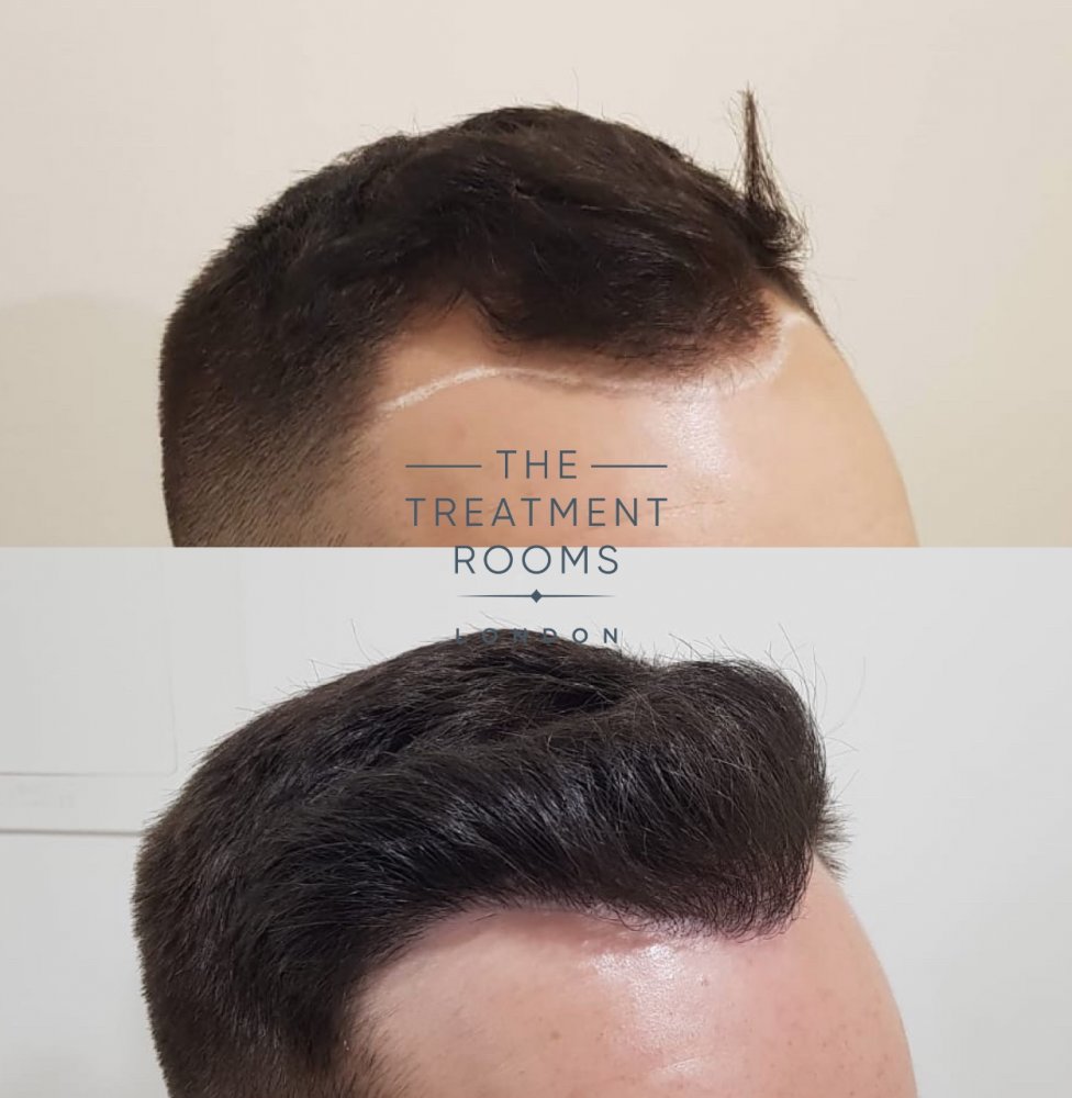 Before and after 3.jpg