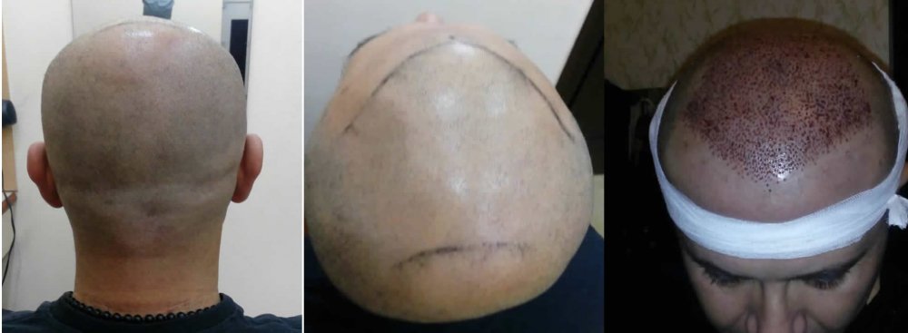 before.jpg