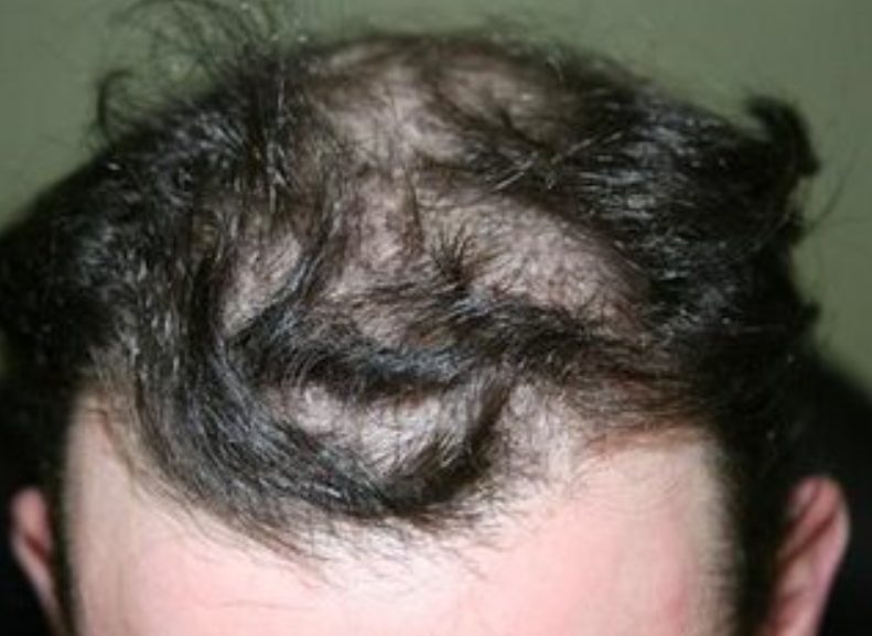 before.jpg