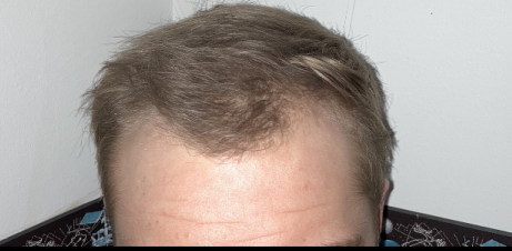 before.PNG