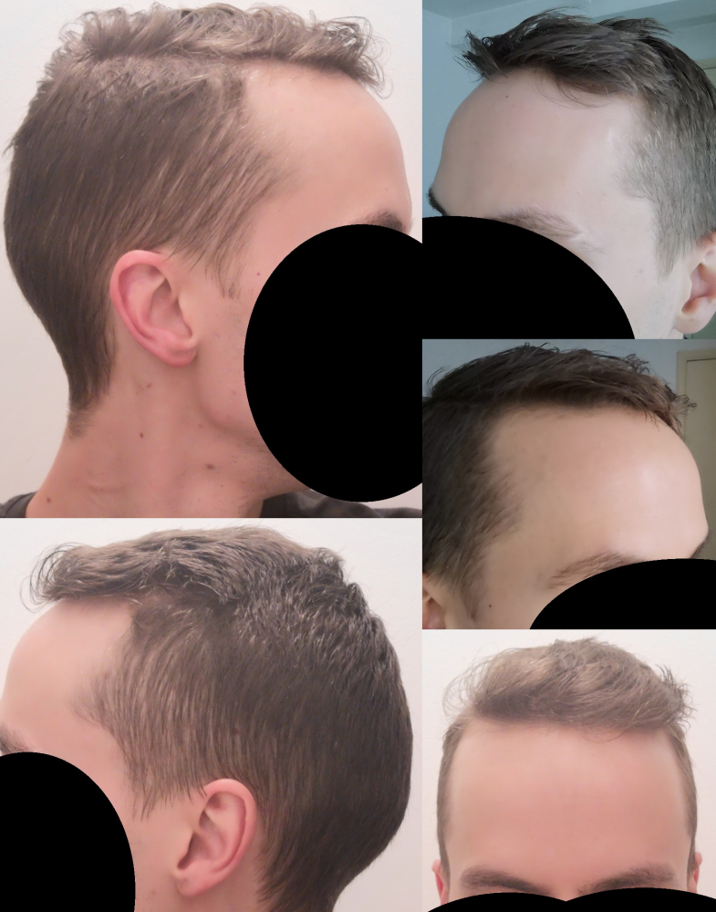 Before.png