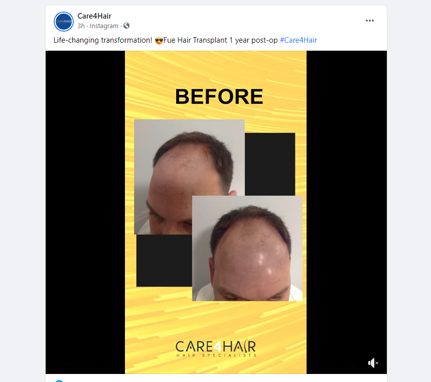 before.PNG