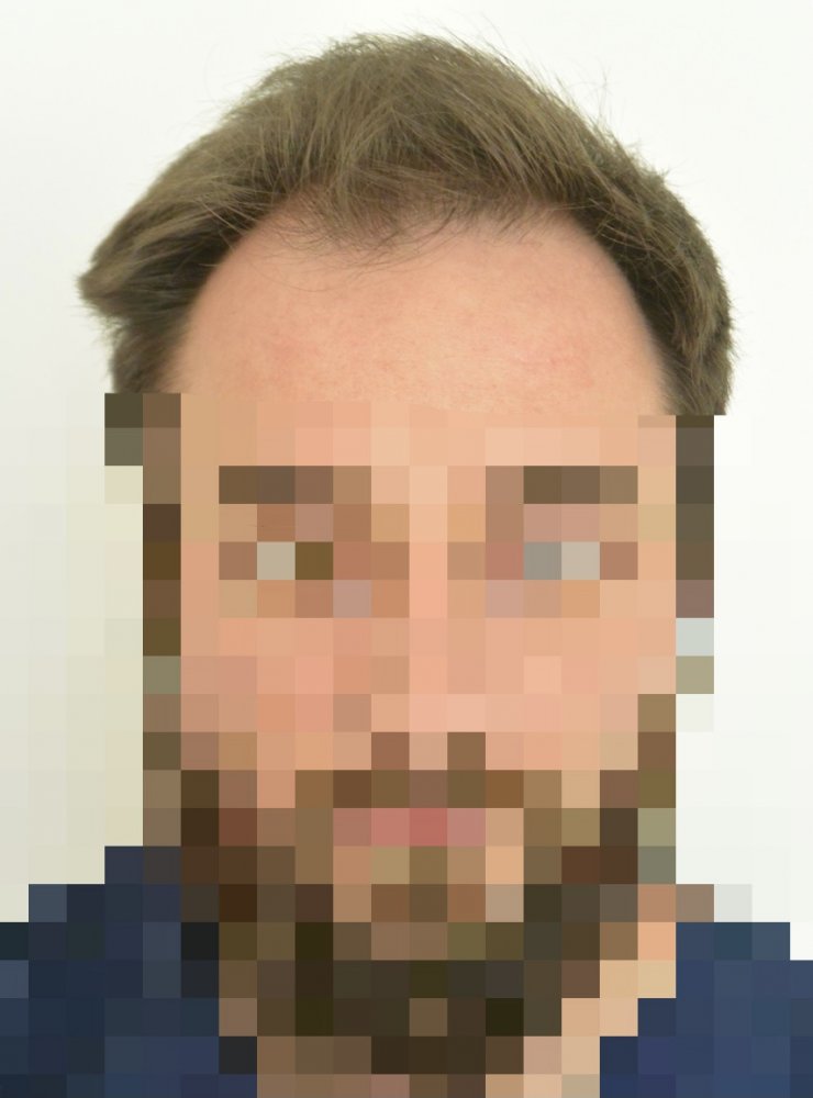 before1.jpg