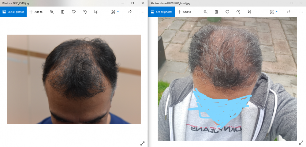Before_after_front.PNG