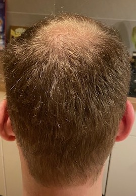 beforesurgery1.jpg