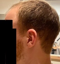 beforesurgery2.jpg
