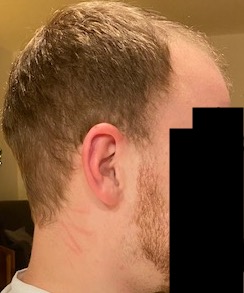 beforesurgery3.jpg