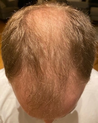 beforesurgery5.jpg