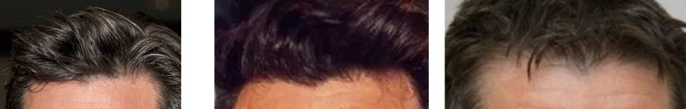 brolin, drago, harket - natural hairline.jpg