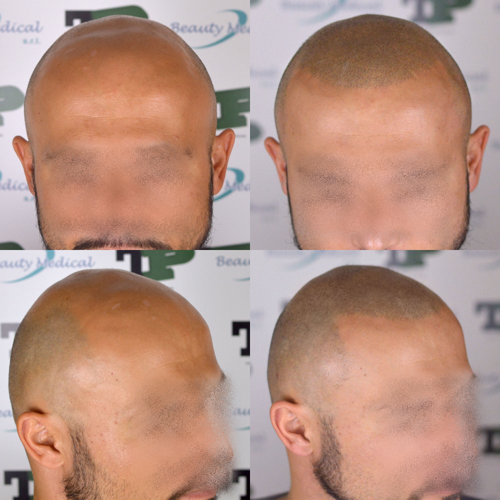 caso57-2.jpg