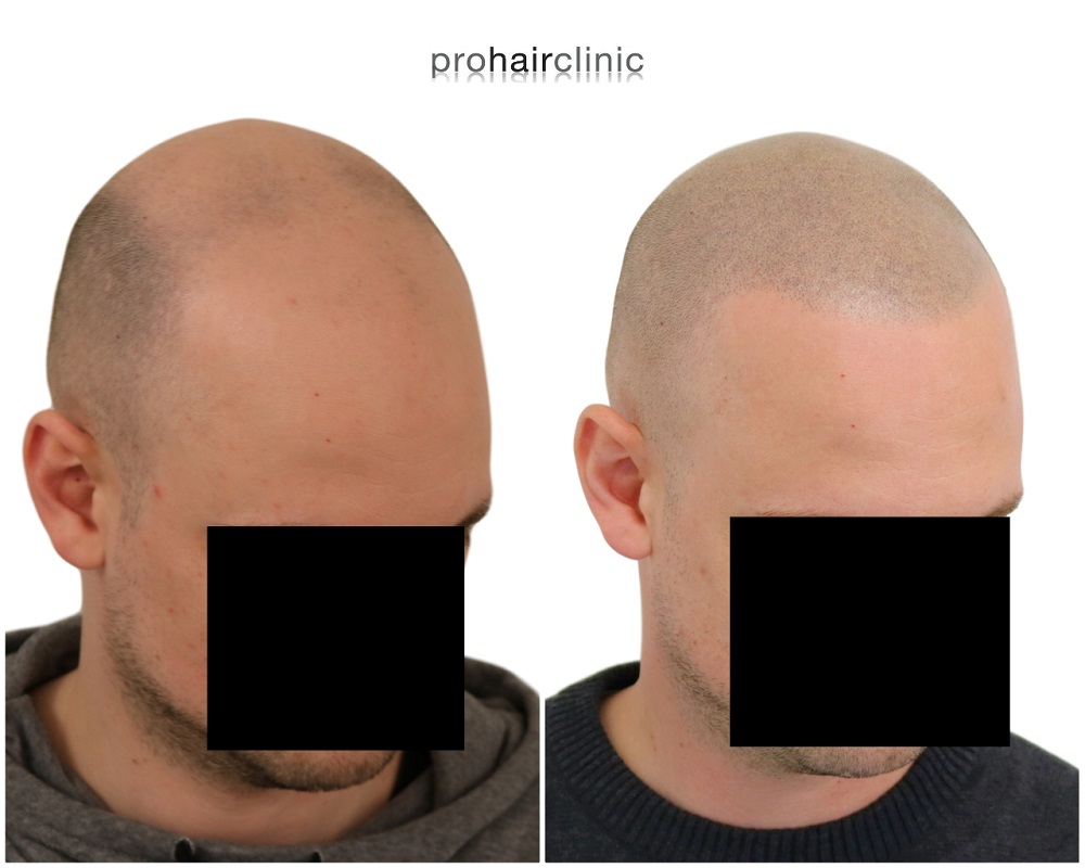 Christophe rechts.jpg
