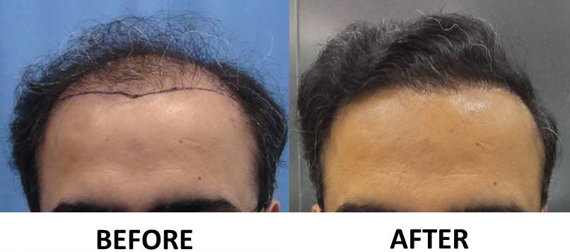 comparison 1.jpg