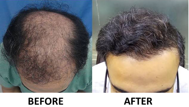 Comparison 2.jpg