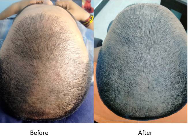 comparison after 3 month  final.jpg