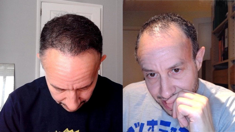 Comparison hair - before + after.jpg