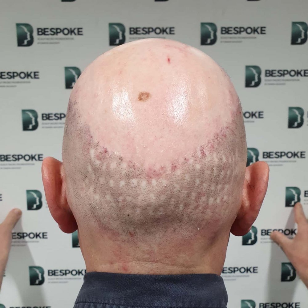 damon scar before.jpg