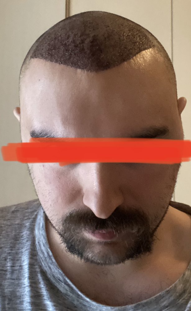 davantidopo.jpg