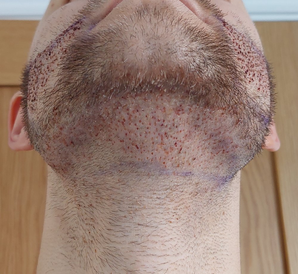 Day 2 (1).jpg