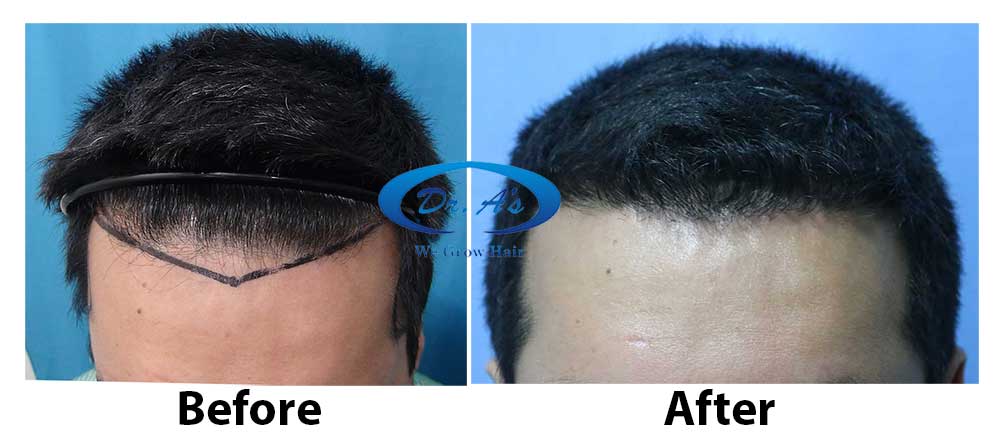Dr Arvind.jpg