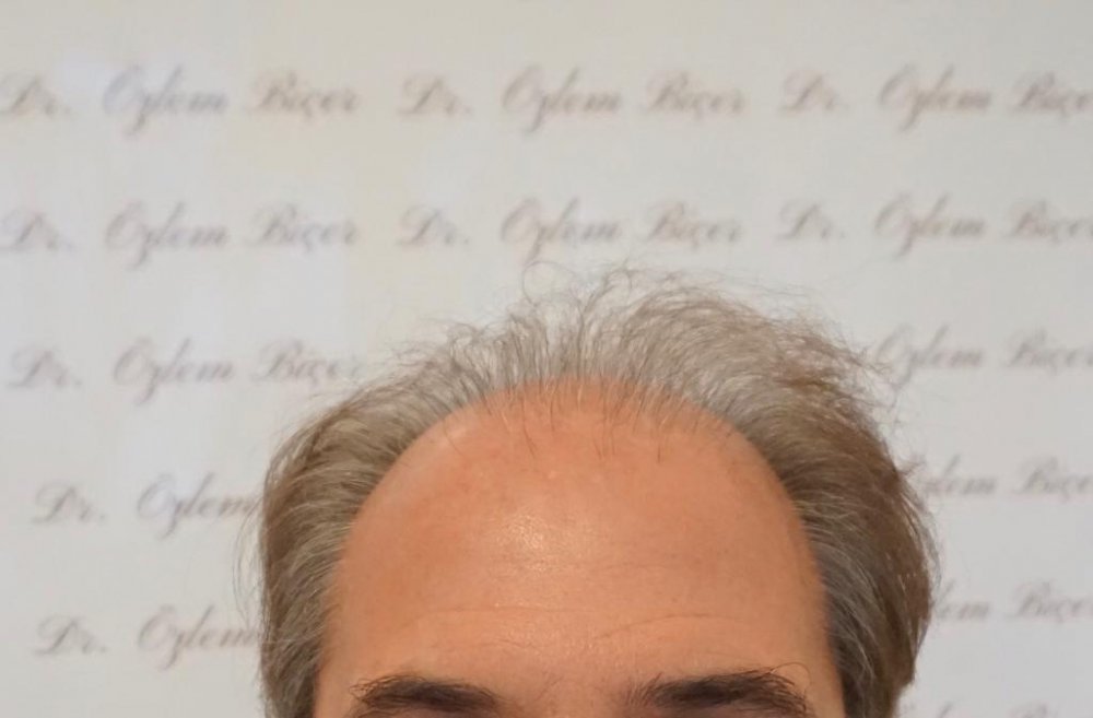 Dr Bicer Scar repair2.jpeg