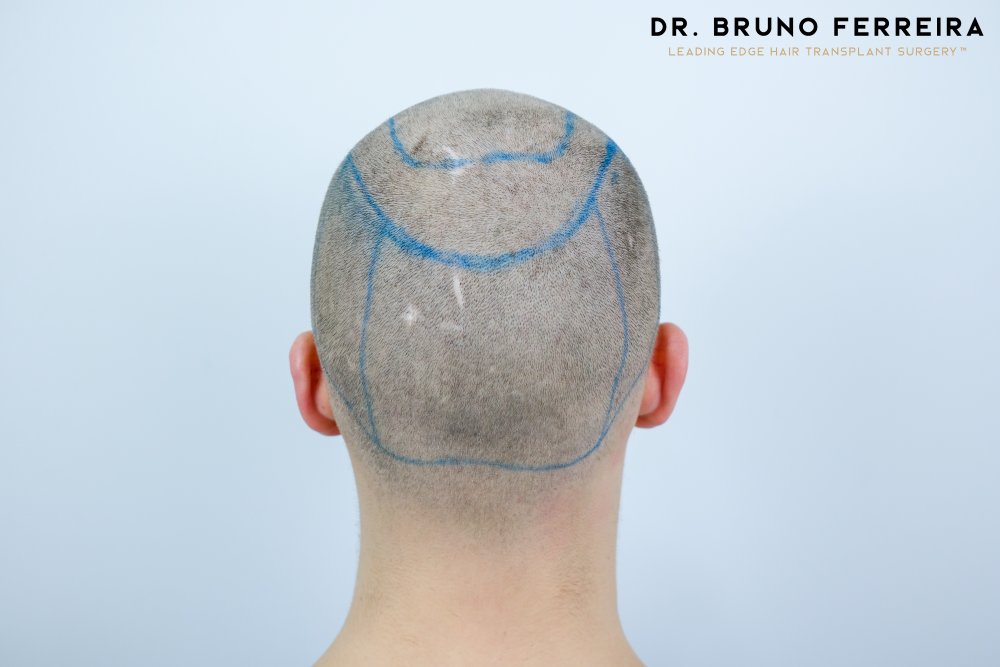 DR. BRUNO FERREIRA - Rolandas S - 0069.jpg