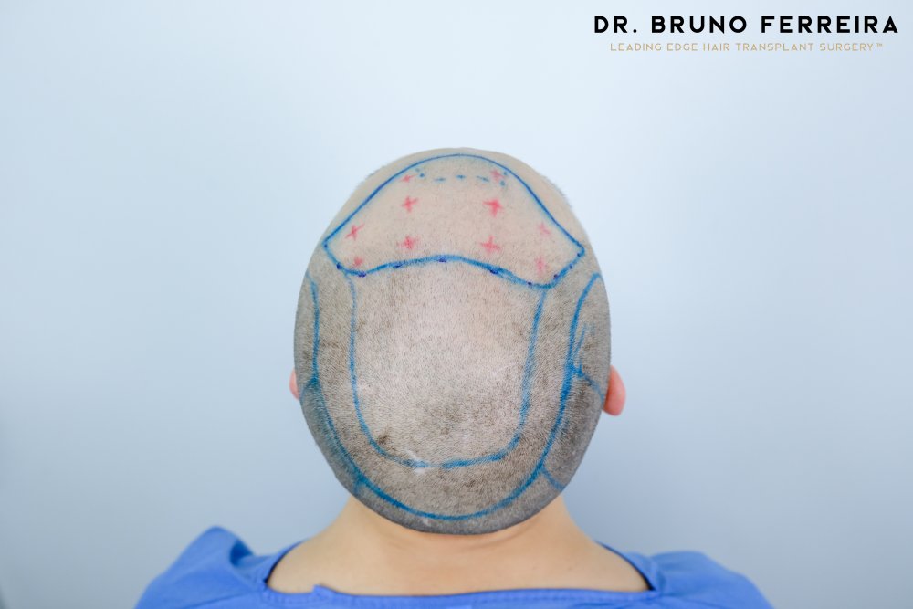 DR. BRUNO FERREIRA - Rolandas S - 0072.jpg