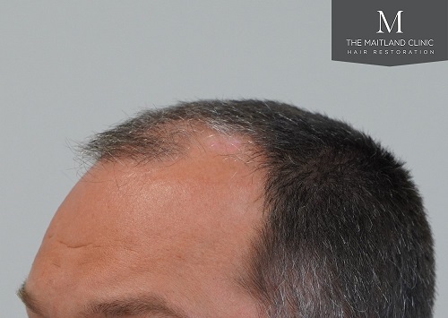 Dr Edward Ball The Maitland Clinic10.jpeg