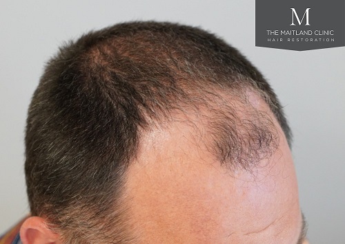 Dr Edward Ball The Maitland Clinic11.jpeg