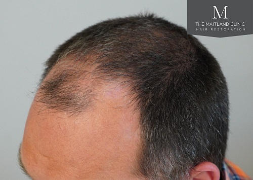 Dr Edward Ball The Maitland Clinic13.jpeg