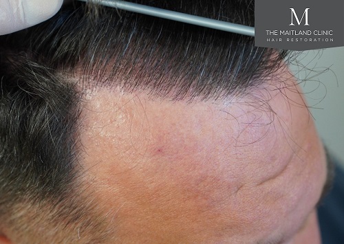 Dr Edward Ball The Maitland Clinic14.jpg