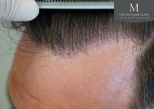 Dr Edward Ball The Maitland Clinic16.jpg