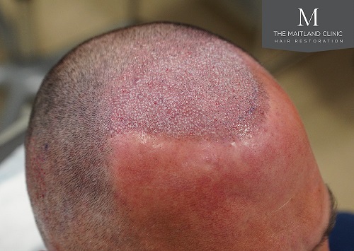 Dr Edward Ball The Maitland Clinic17.jpg