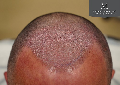 Dr Edward Ball The Maitland Clinic18.jpg