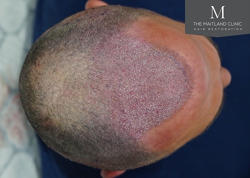 Dr Edward Ball The Maitland Clinic19.jpg