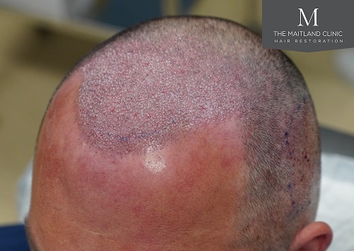 Dr Edward Ball The Maitland Clinic20.jpg