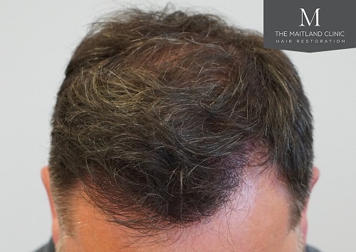 Dr Edward Ball The Maitland Clinic4.jpg