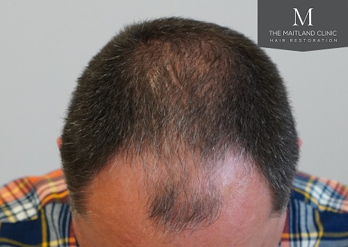 Dr Edward Ball The Maitland Clinic5.jpg