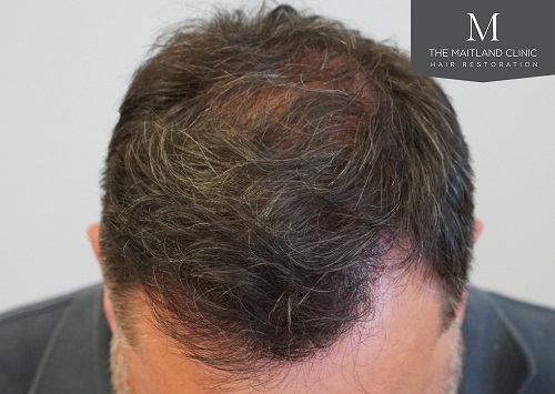 Dr Edward Ball The Maitland Clinic6.jpg