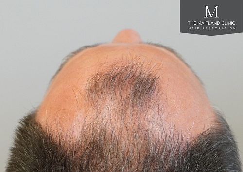 Dr Edward Ball The Maitland Clinic7.jpeg