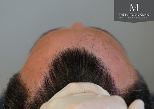 Dr Edward Ball The Maitland Clinic8.jpeg