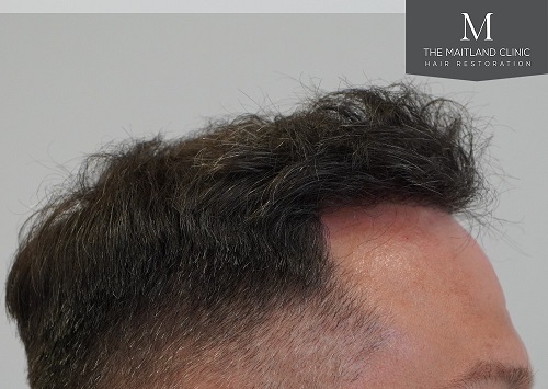 Dr Edward Ball The Maitland Clinic9.jpeg