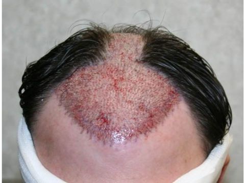 Dr Feller imm post op 2.jpg