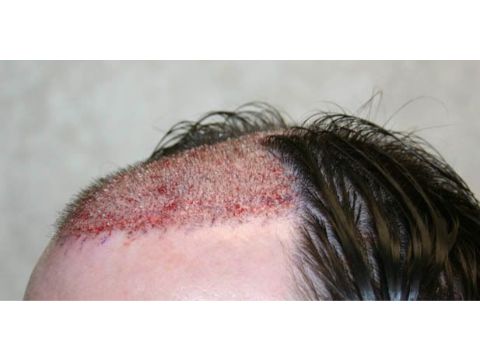 Dr Feller imm post op 4.jpg