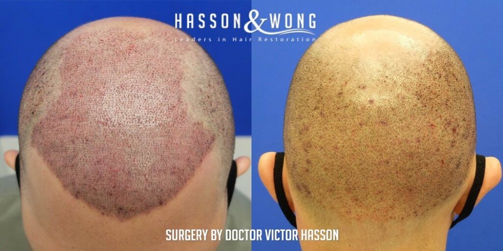 Dr Hasson12.jpg