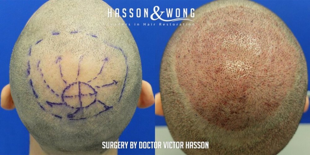 Dr Hasson13.jpg