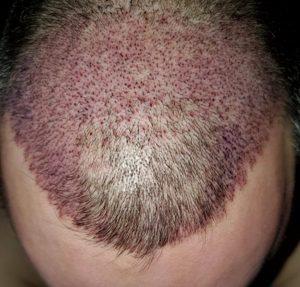 Dr Ron ShapiroDr David Josephitis of Shapiro Medical Group1.jpg