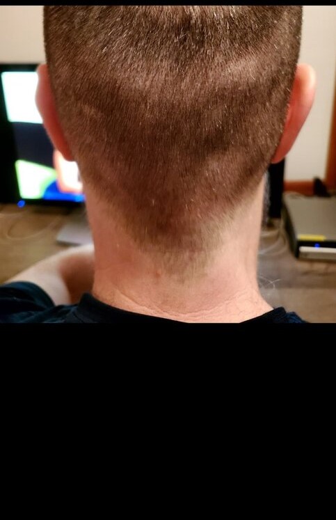 Dr Ron ShapiroDr David Josephitis of Shapiro Medical Group10 donor.jpg