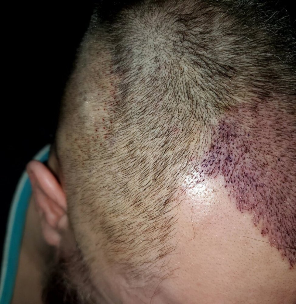 Dr Ron ShapiroDr David Josephitis of Shapiro Medical Group2.jpg