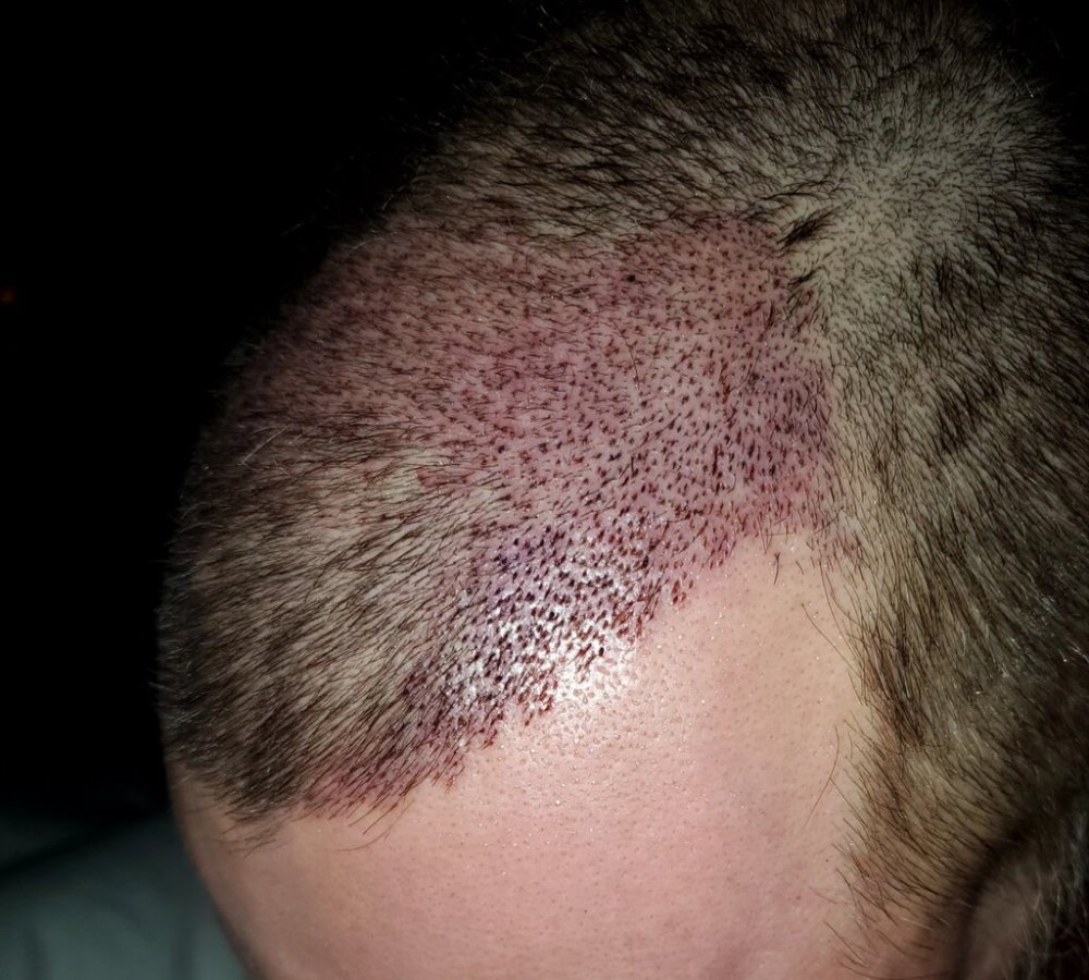 Dr Ron ShapiroDr David Josephitis of Shapiro Medical Group3.jpg