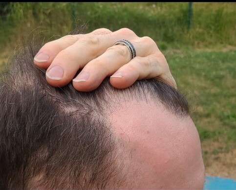 Dr Ron ShapiroDr David Josephitis of Shapiro Medical Group4.jpg